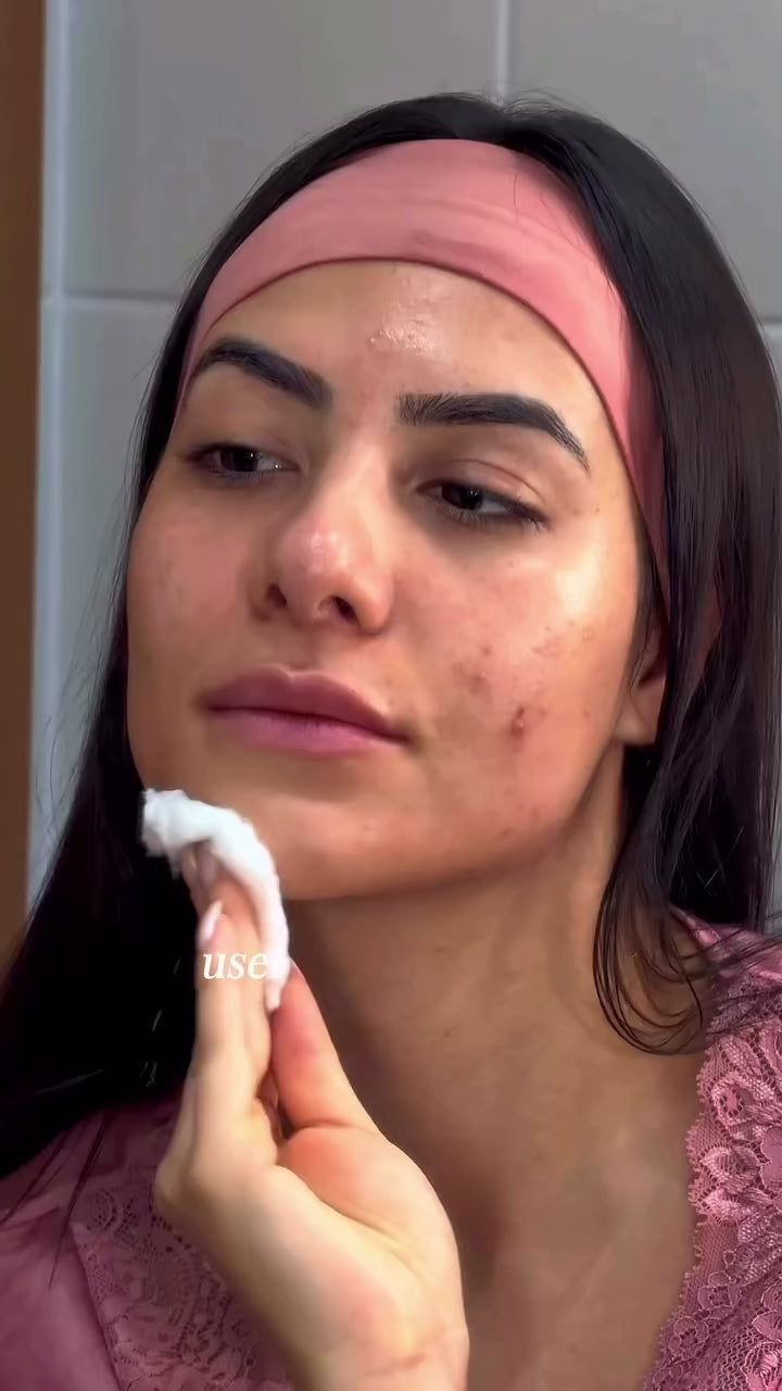 Carregar vídeo: Kit Antiacne